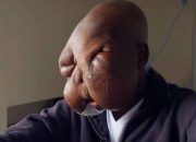 Derita Tumor Ganas, Anak Ini Sengaja Ditinggal Ibunya